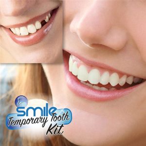Instant smile - fogsor javító készlet vészhelyzet esetére - ideiglenes fogpótlás készítő (FX) (BBM) - Image 5